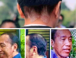 Wajah Jokowi yang Kusam dan Banyak Flek Diduga Akibat Stres Didera Isu Ijazah Palsu