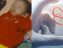 Menkes Sebut Penyebab Kematian Balita Sukabumi bukan Cacing, Dokter Ungkap Kisah Pilu Saat Membantu Sang Bocah