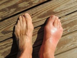 Rutinitas Pagi untuk Kendalikan Asam Urat, Ini yang Perlu Dilakukan